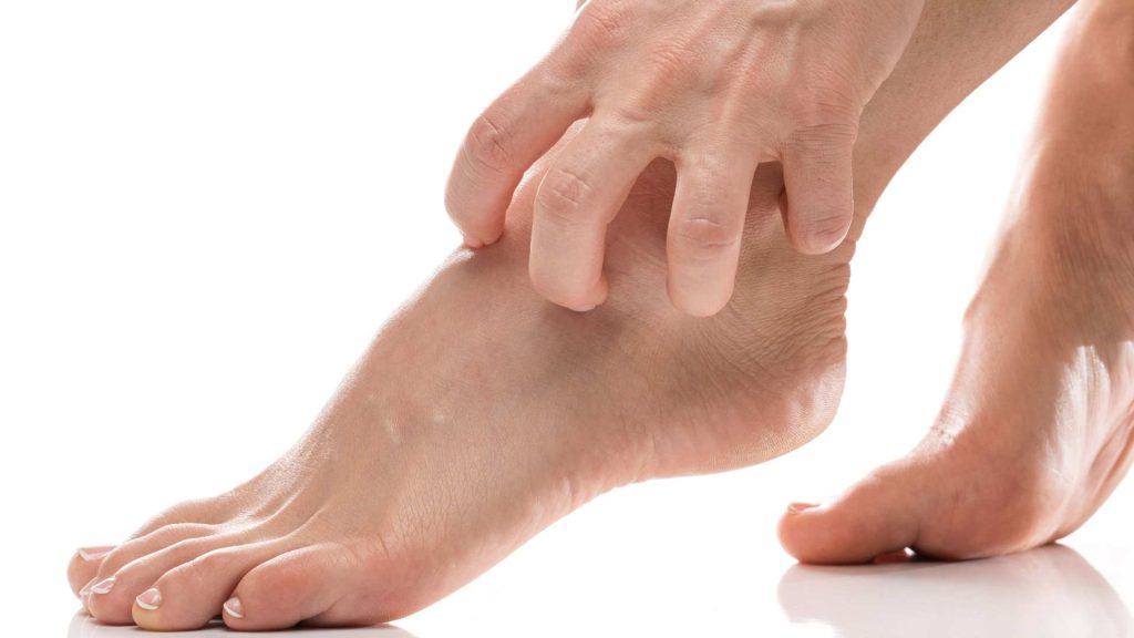 cara menghilangkan gatal di kaki